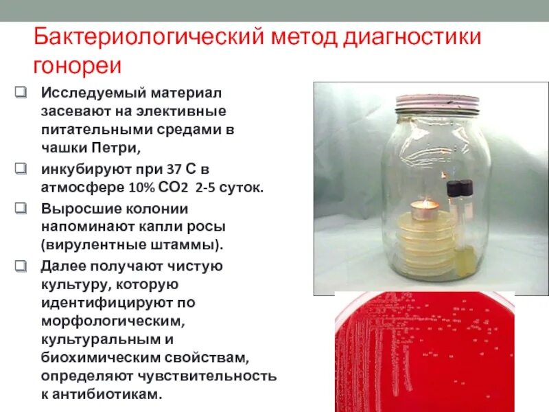 Бактериологический метод диагностики. Бактериологический метод исследования этапы. Бактериологический метод исследования питательные среды. Классический бактериологический метод. 2 этап бактериологического метода