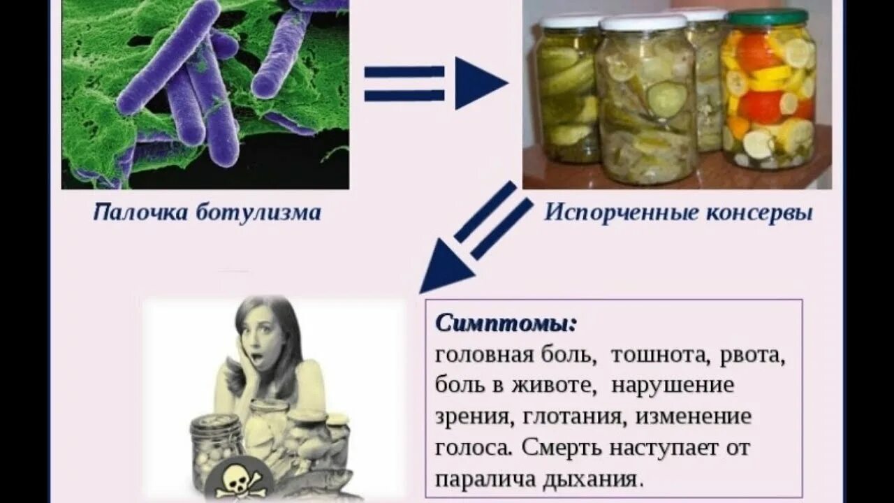 Ботулизм симптомы. Ботулизм возбудитель отравление. ботулизм симптомы меры возбудители. ботулизм возбудитель симптомы. пищевая инфекция ботулизм.