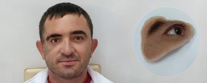 Протезирование лица. Челюстно лицевые протезы. челюстно лицевое протезирование.
