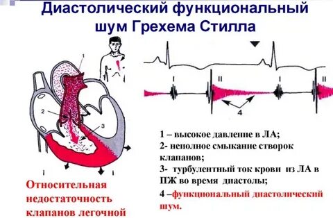 Функциональный шум