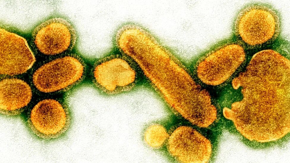 Грипп вызывают бактерии. Вирус h1n1 испанка. испанский грипп h1n1 вирус. вирус серотипа h1n1 испанка. вирус h1n1 испанка под микроскопом.