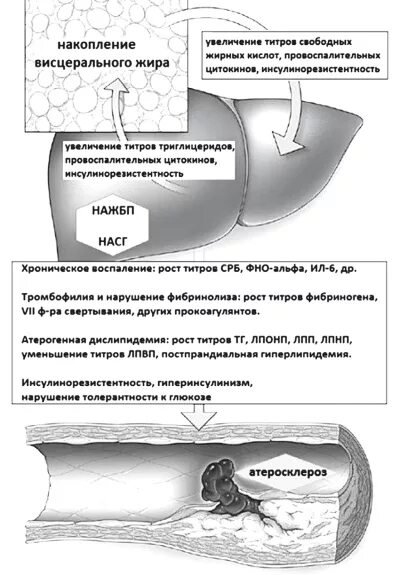 Наиболее часто у пациентов с нажбп встречается. Патогенез нажбп. неалкогольная жировая болезнь печени (нажбп). факторами риска жировой болезни печени. нажбп история болезни.