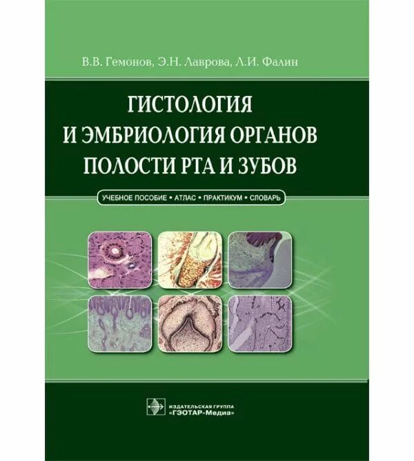 Л. Строение мягкого неба гистология. Десна гистология препарат. Гемонов гистология. Гистологическое строение десны.