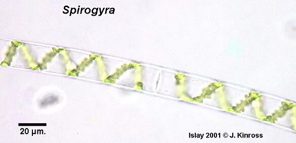 Спирогира питание. Спирогира под микроскопом. Spirogyra зачистной шнек. Барбара Гэскин Spirogyra. Спирогира препарат под микроскопом.