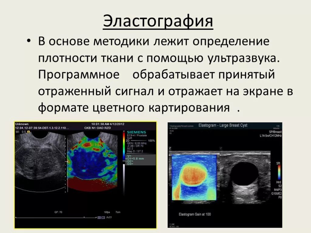 Эластография эластография чем отличается. Узи печени с эластометрией. Эластография эластография чем отличается. Ультразвуковая компрессионная эластография. Эластография сдвиговой волны.