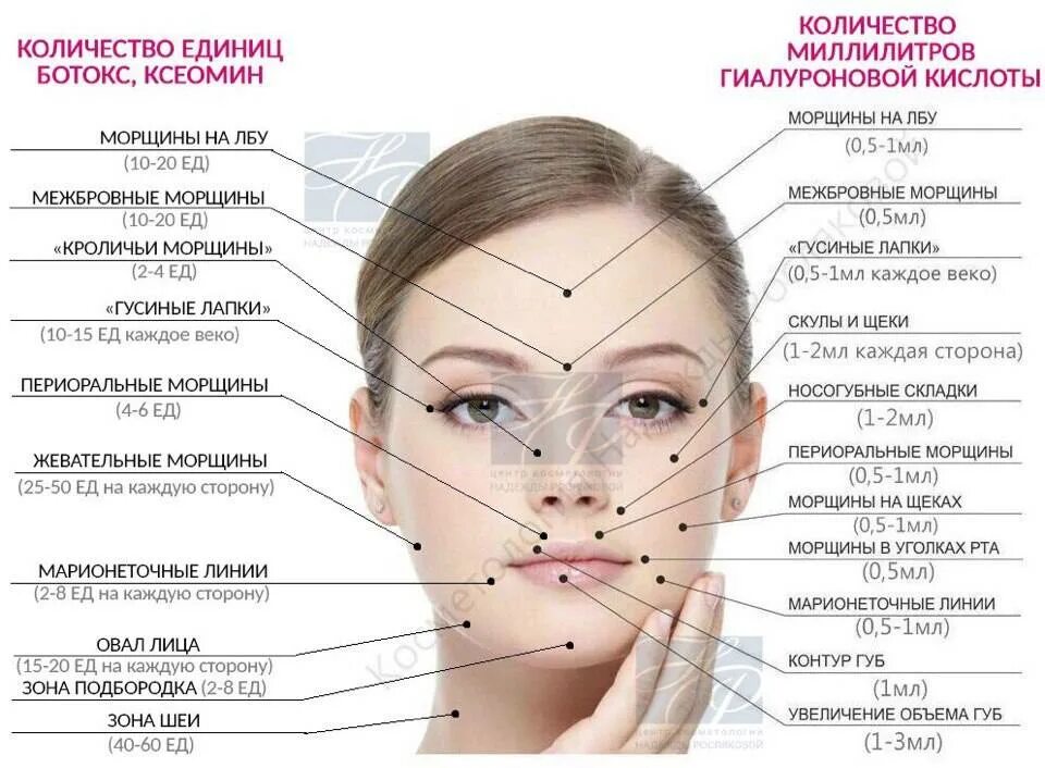 Диспорт лоб единицы. Схема введения ботокса в лоб. Схема введения ботокса на лице. Ботокс в лоб схема введения. Схема уколов ботокса на лице.