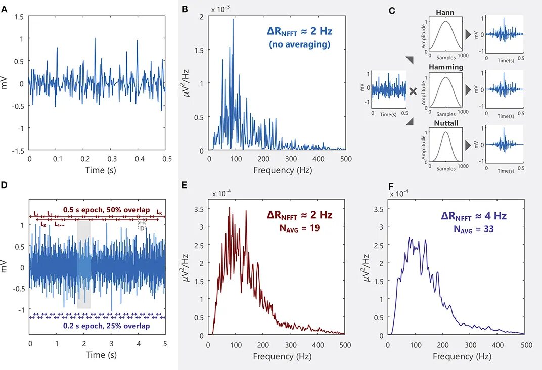 Signal record. Emg signal. emg signal processing. frequency domain. 2-gfsk signal spectrum.