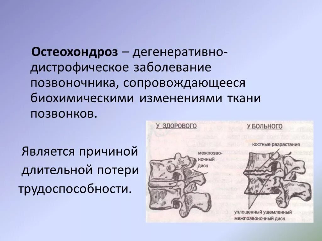 Дегенеративные поражения позвоночника. Дегенеративно-дистрофические заболевания позвоночника. Дегенеративно-дистрофические поражения позвонков. Дегенеративно-дистрофические заболевания позвоночника (ддзп).