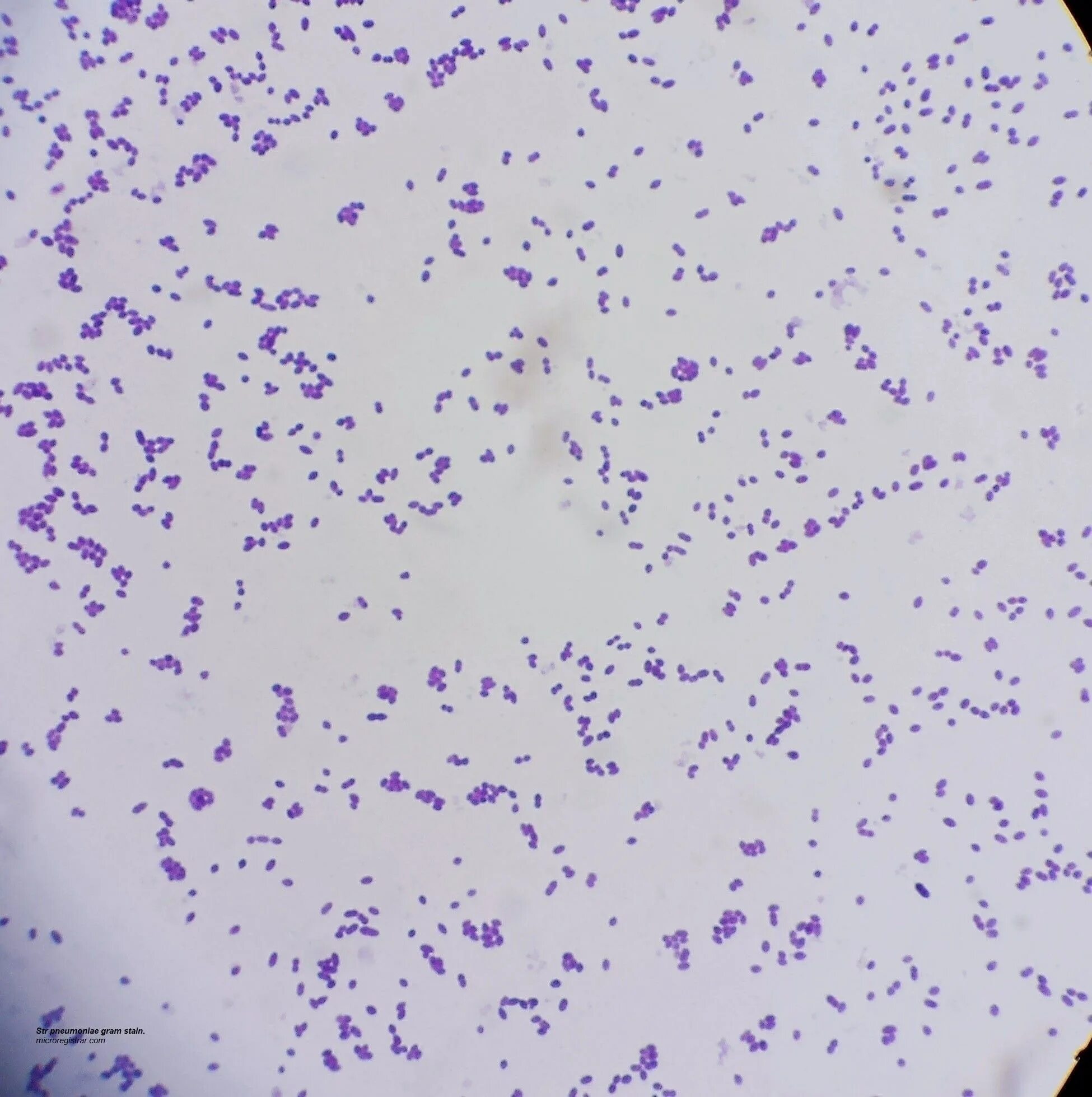 Микроскопия по граму. Микроскопия мазка со стафилококками. Микроорганизмы стрептококк  agalactiae. Микроскопия по граму. Грамотрицательные кокки мазок микроскопия.