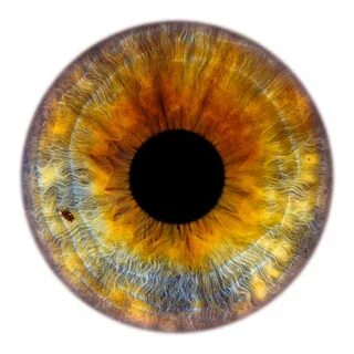 Won eye