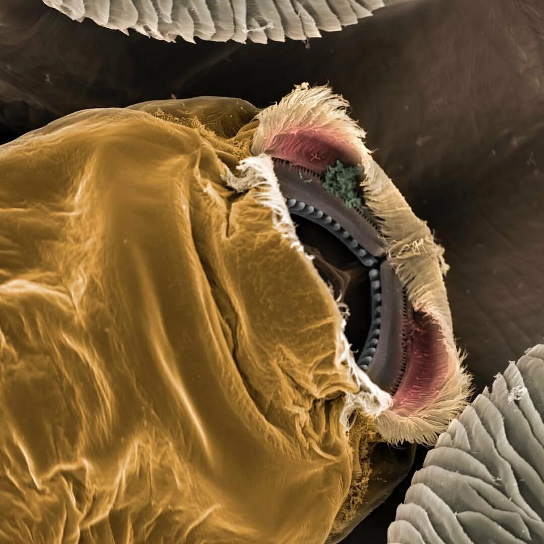 Мошка под микроскопом фото. Зубы мошки под микроскопом. Мошка под микроскопом челюсти. Глист под микроскопл.