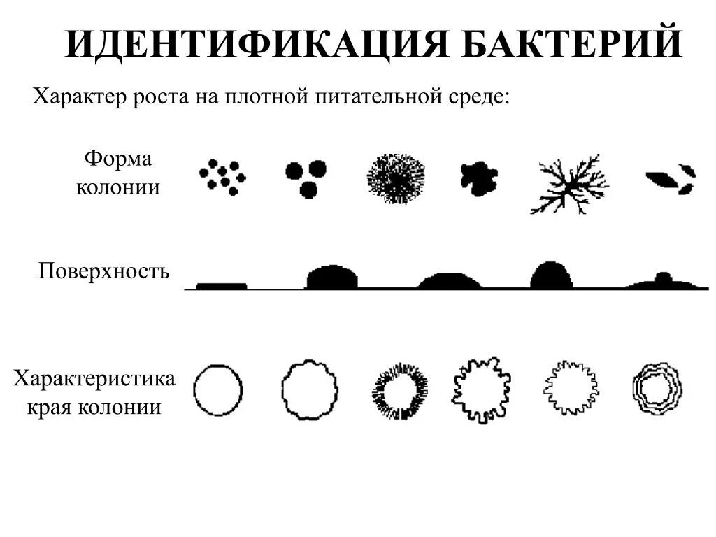 Свойства идентификации бактерий. Характер роста бактерий на питательных средах. Рост колоний микробов на плотных питательных средах. Формы колоний микроорганизмов на плотных питательных средах. Идентификация бактерий схема.