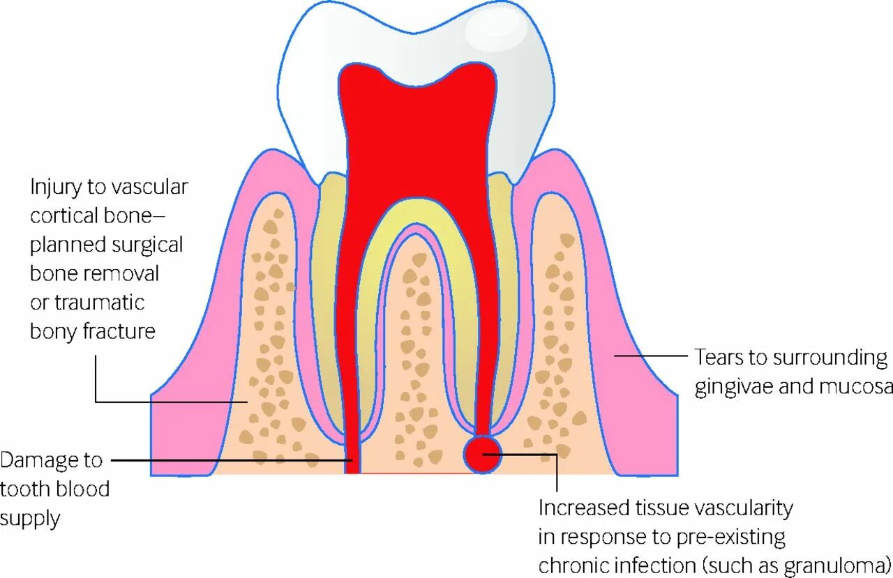 Почему кровь из зубов