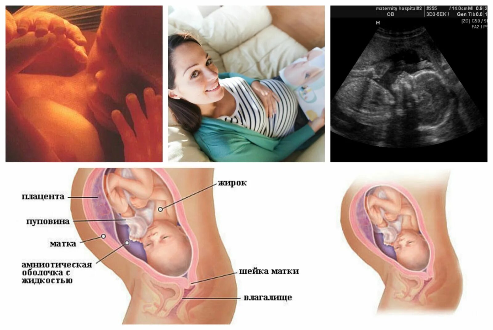 Ребёнок на 25 неделе беременности. Малыш на 25 неделе беременности. Плод на 25 неделе беременности. 25 неделя отзывы