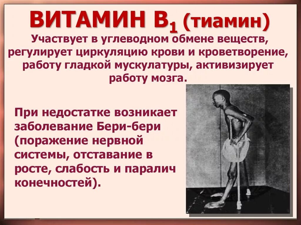 Какие заболевания при недостатке витамина в1. Недостаток витамина в1 бери бери. Болезни при недостатке витамина в1. Недостаток витамина тиамина.