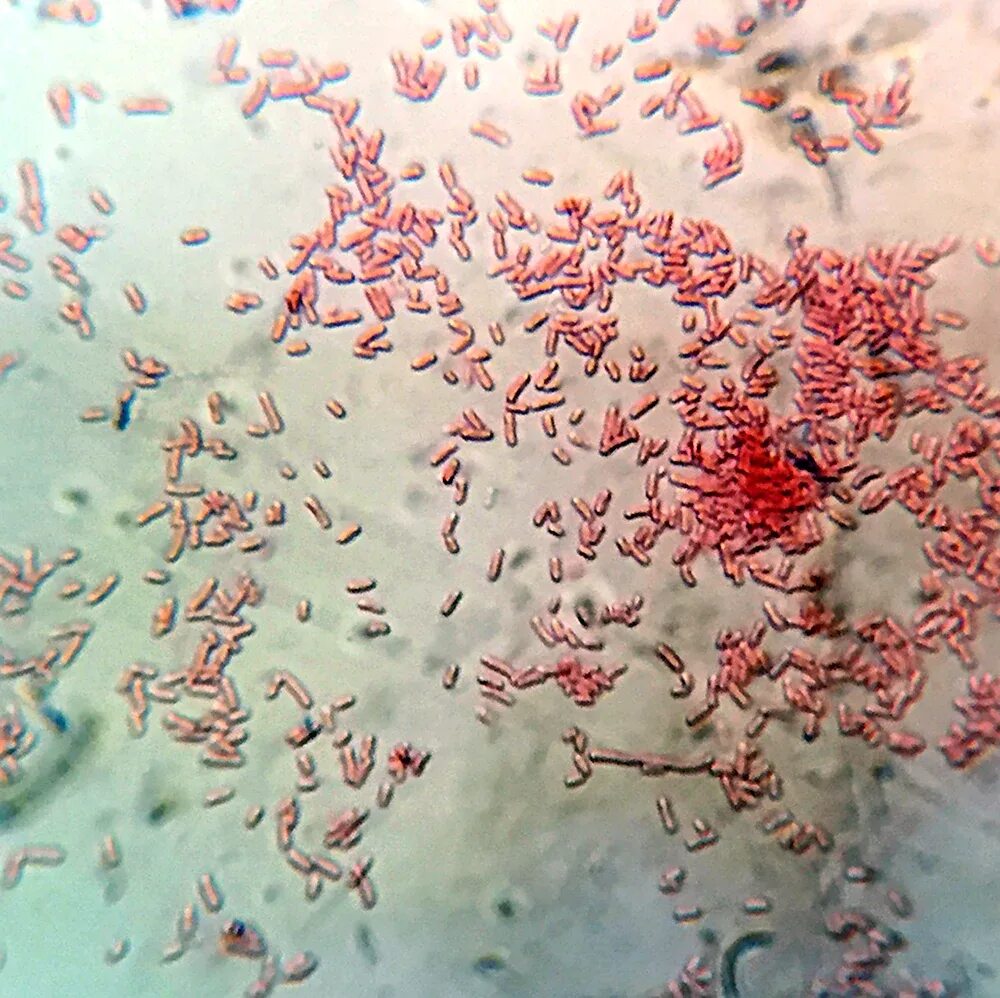 Spp salmonella spp shigella spp. Shigella flexneri микробиология. shigella dysenteriae микробиология. бактерии шигеллы. shigella sonnei микробиология.