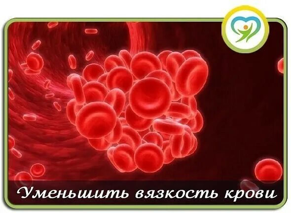 Вязкость крови. Пониженной вязкости крови.. Повышение вязкости крови. Синдром повышенной вязкости крови.