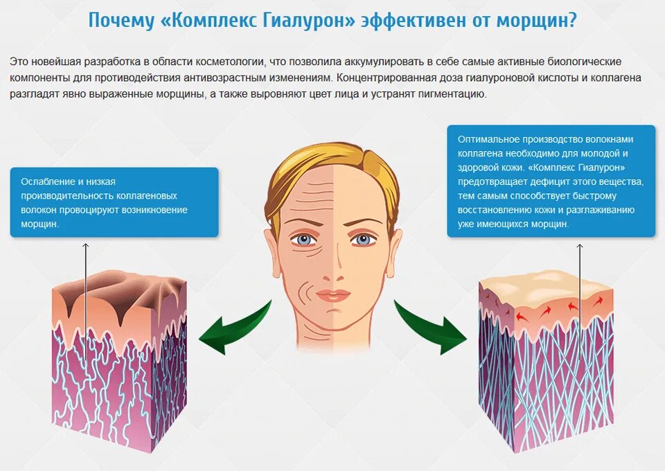 Гиалуроновая кислота в коже. Влияние коллагена на кожу. Коллаген эластин гиалуроновая кислота. Эффект коллагена для лица. Гиалуроновая кислота что это такое