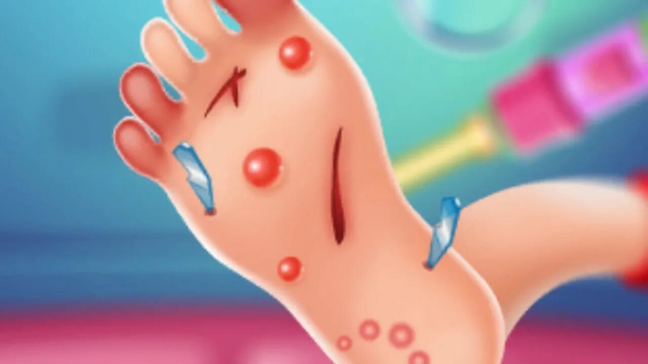 Игры нога лечить. Доктор под водой игра для девочек. Игры нога лечить. Стопа для игры. Игра вылечи.