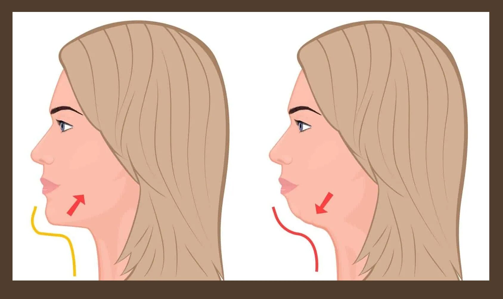 Почему 2 подбородок. Второй подбородок в профиль. Вторрй подбородо. Эффект второго подбородка упражнения. Двойной подбородок сбоку.