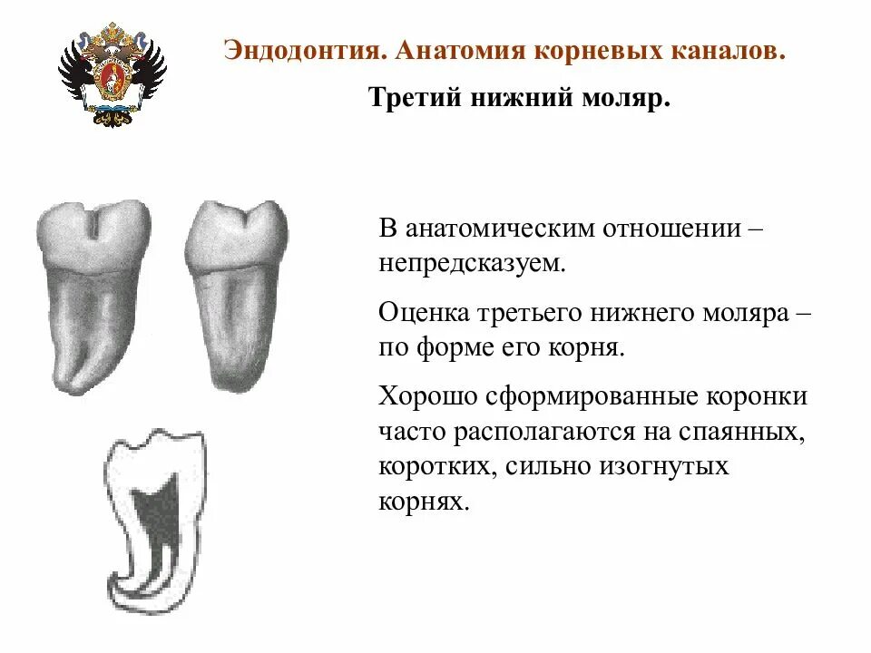 Верхние и нижние каналы. Нижний моляр анатомия корневых каналов. Второй моляр нижней челюсти анатомия корневых каналов. Анатомия корневых каналов моляров. Третий Нижний моляр анатомия.