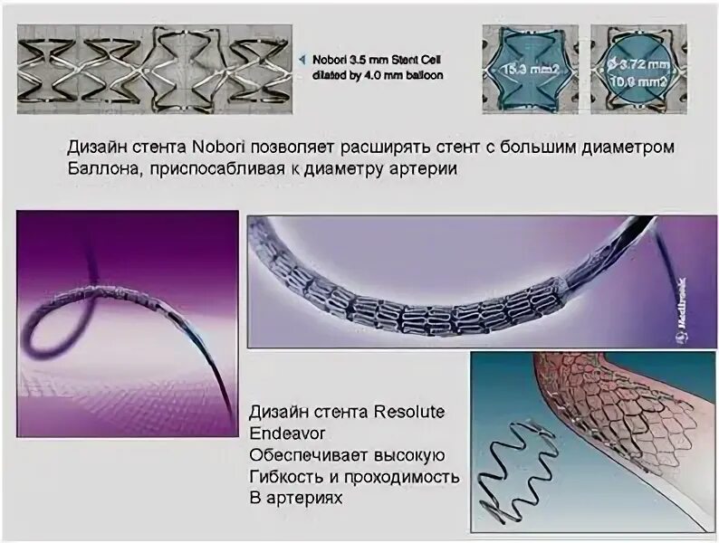 Лекарственный стент. Стент коронарный Resolute Integrity 2.75x14 мм. Resolute Integrity стент. Конфигурации компонентов стент-графтов Endurant II. Саморасширяющиеся металлические стенты..