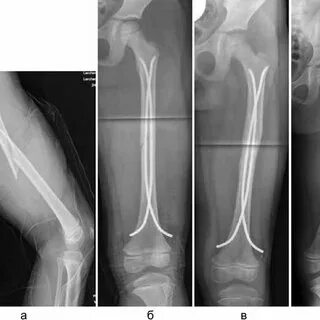 Ол менің есегімді аяғымен трахает