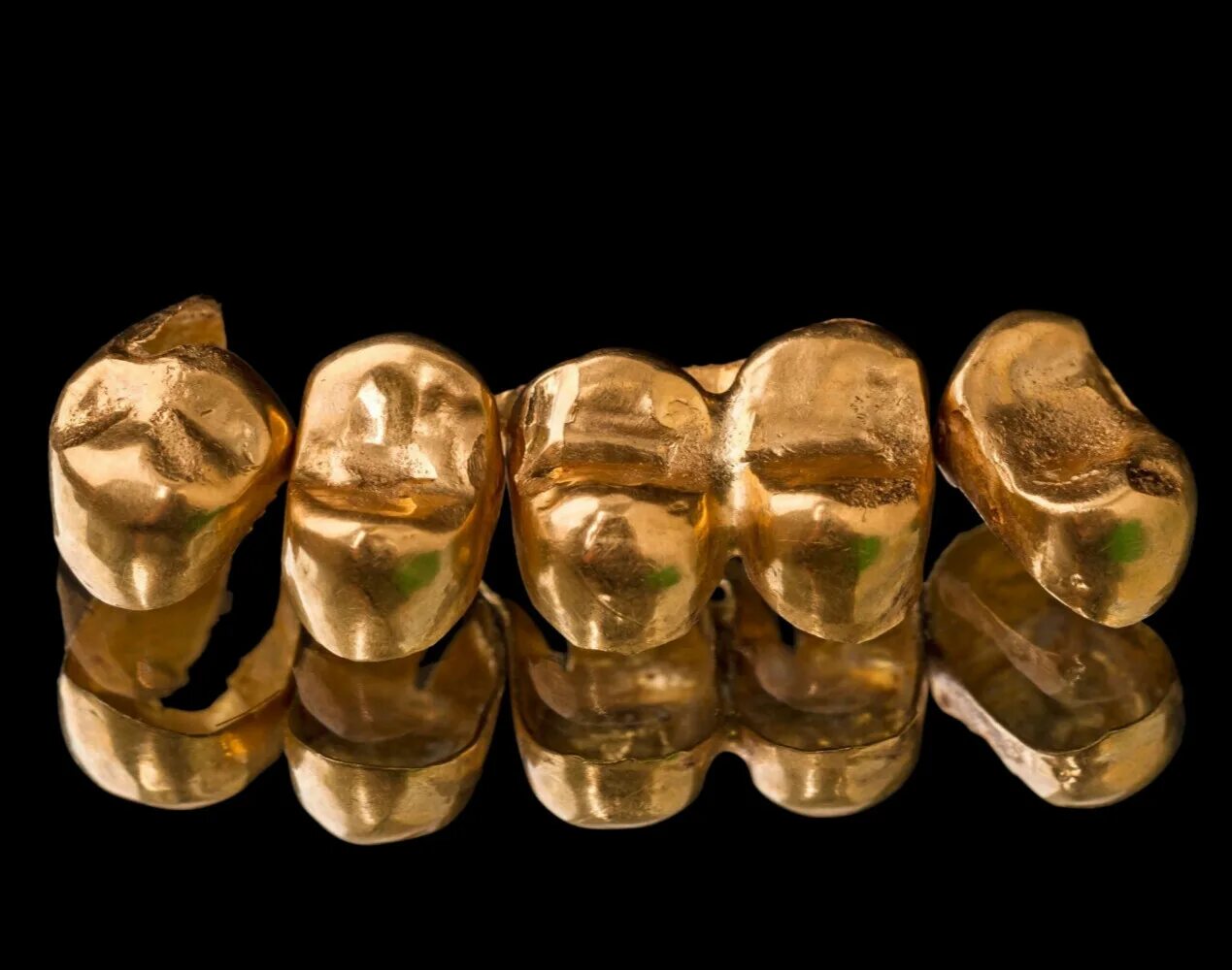 Коронки 850 проба золотые. Золотая штампованная коронка 900 пробы. Сплав золота 900 пробы в стоматологии. Сплав 750 пробы в стоматологии.
