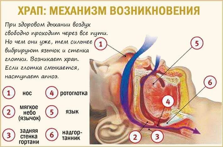 Почему люди храпят во сне как избавиться. Причины храпа. Храп механизм возникновения.