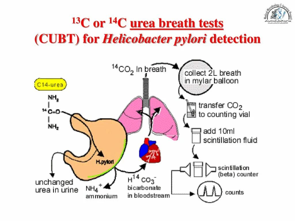 Как подготовиться к хеликобактер дыхательный. Helicobacter pylori Breath Test. Test for h.pylori. C Breath Test больше 50. Urea breathing Test.