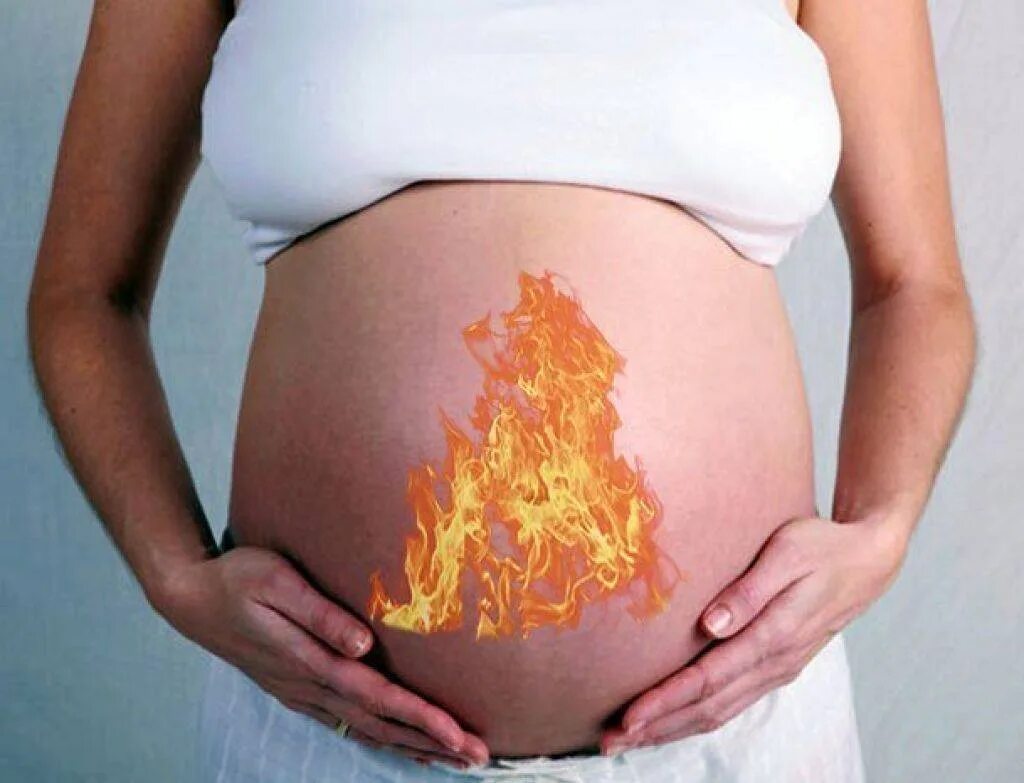 Болит желудок второй триместр. Изжога при беременности. Изжоге прибеременночти. Изжога беременность 3 триместр.