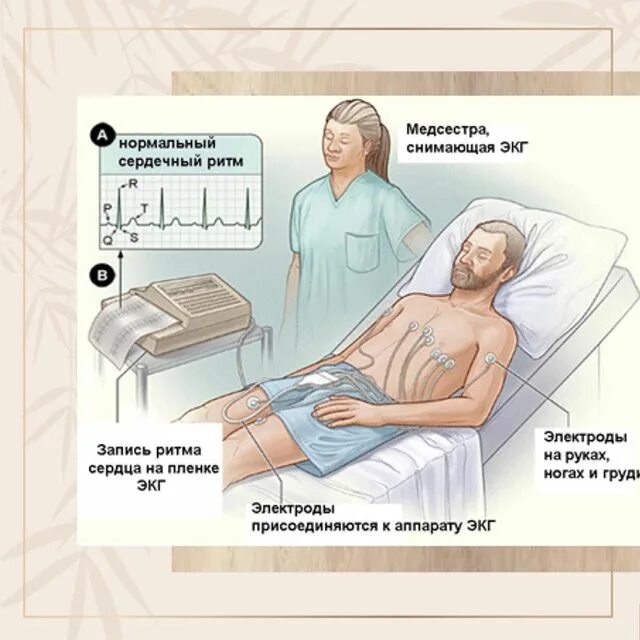 Техника проведения экг. Алгоритмы экг-диагностики гипертрофии. Подготовка пациента к проведению экг. Экг цель исследования подготовка пациента. Методика проведения экг алгоритм.