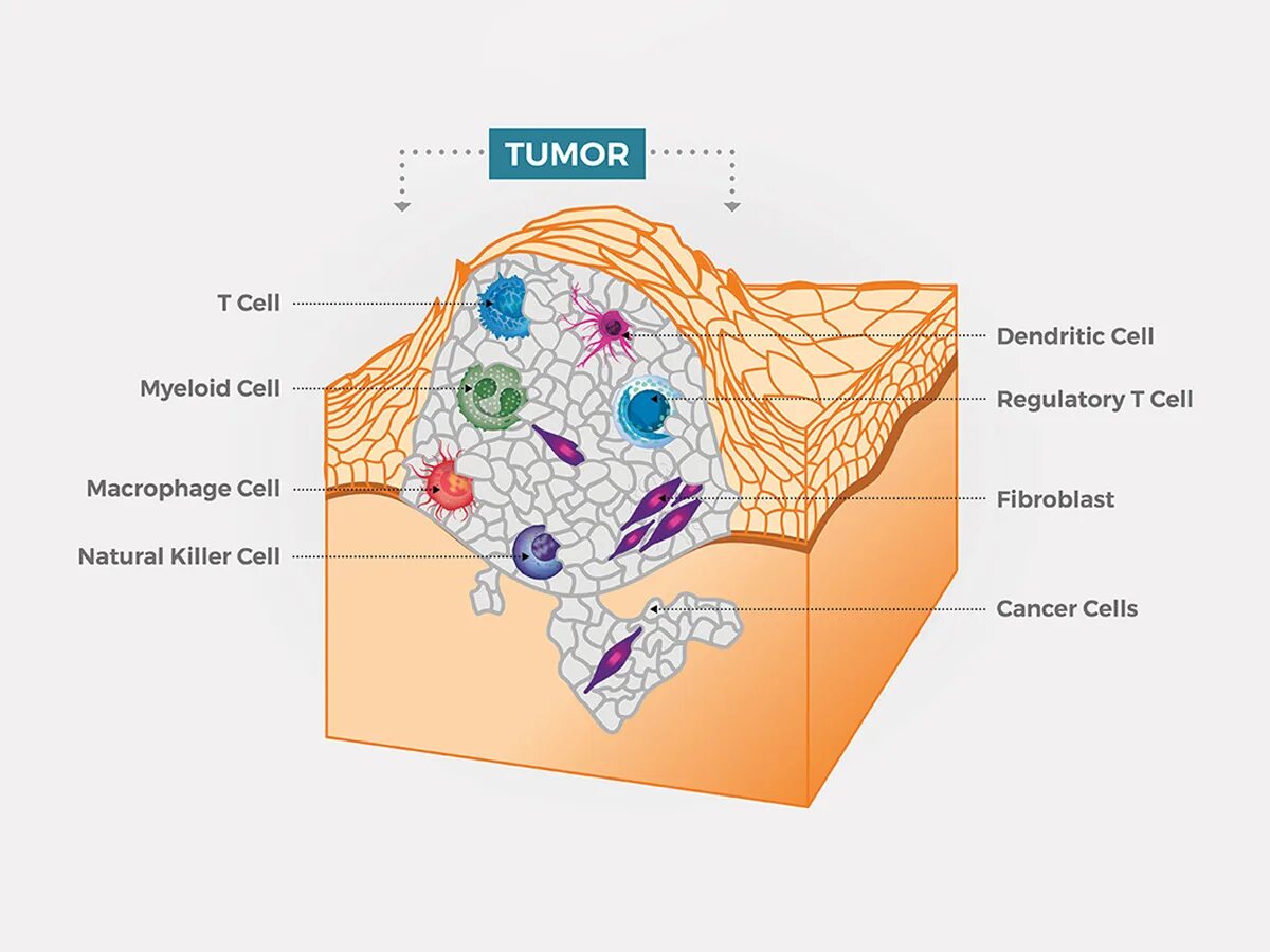 Tumor cells