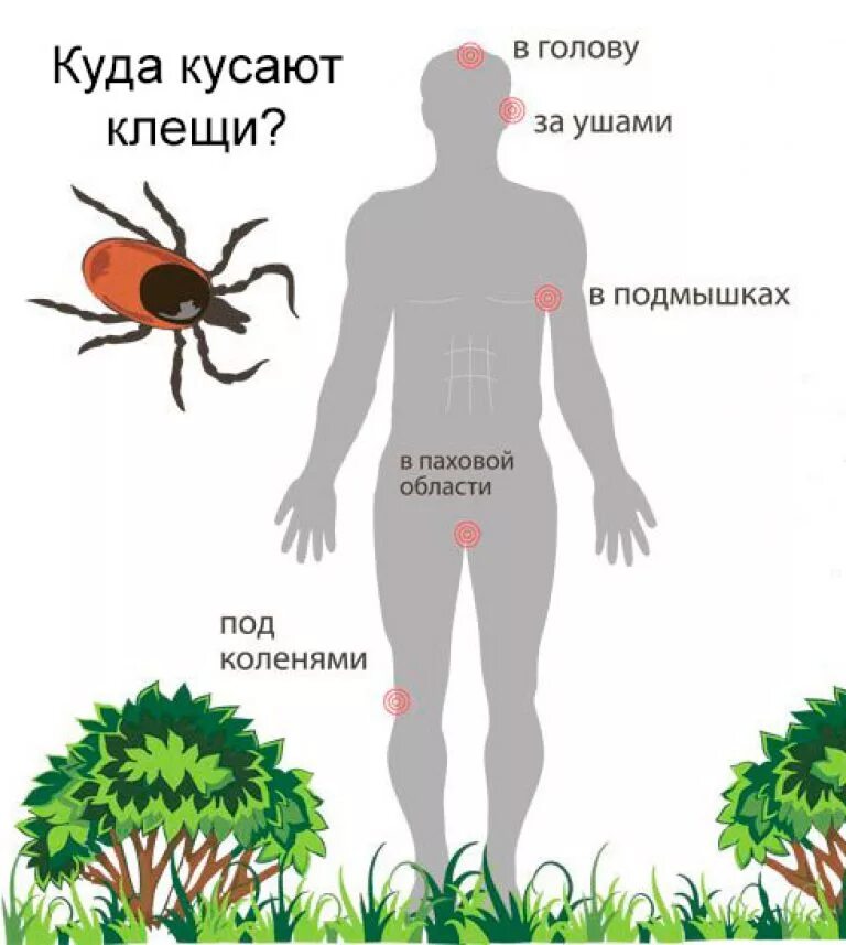 Опасен ли энцефалит. Как выглядит укус клеща. Как выглядит укус энцефалитного клеща. Как выглядят укусы клещей.