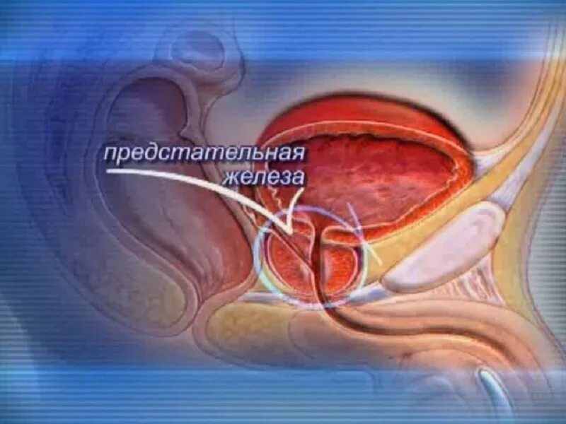 Предстательная железа у мужчин видео. Предстательная железа у мужчин. простата и предстательная железа. предстательная железа фото.