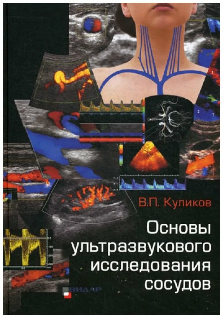 Ультразвуковая диагностика книги. Куликов основы ультразвукового исследования сосудов. Куликов основы УЗИ сосудов. Куликов ультразвуковая диагностика сосудистых заболеваний. Куликов книга по УЗИ сосудов.