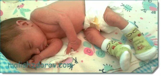 живот на следующий день после родов. живот на 35 неделе беременности. поза на четвереньках для беременных. 35 недель можно ли заниматься. опустившийся живот перед родами.