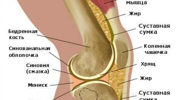 Если болит чашечка колена. Чашечка коленного сустава. Болит колена внутренняя. Пателлофеморальный болевой синдром. Пателлофеморальный синдром колено.