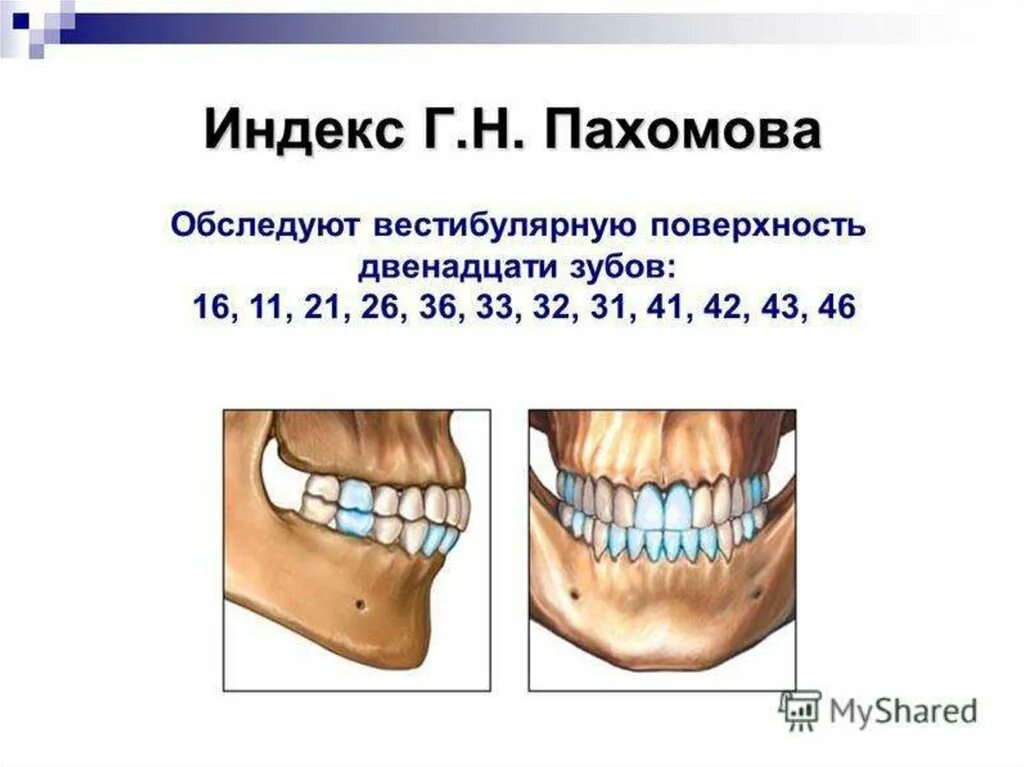 Индексы состояния полости рта. Индекс гигиены в стоматологии. Индекс гигиены полости рта. Индексы гигиены полости рта в стоматологии. Индекс Грина Вермиллиона в стоматологии методика.