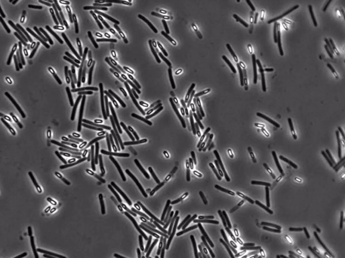 Клостридии диффициле морфология. Clostridium pasteurianum. Clostridium botulinum микроскопия. Сульфитредуцирующие клостридии мазок.