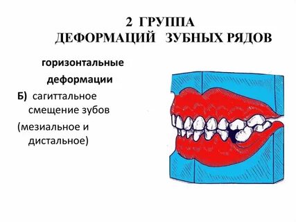 Деформация группа