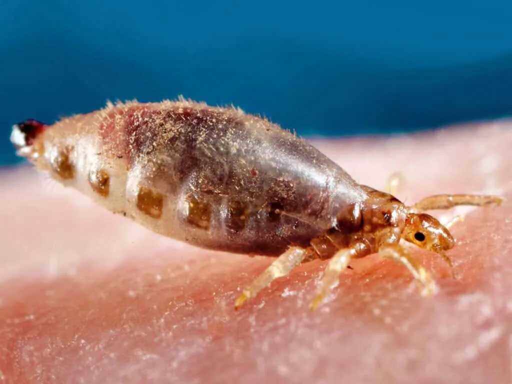 Головная вошь (Pediculus humanus capitis). Мандавошки бельевые вши. Вшей во сне видеть к чему снится