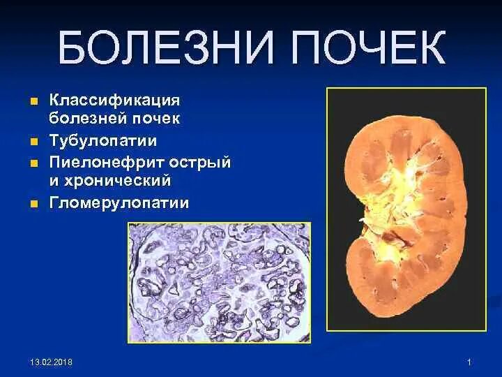 Общее заболевание почек. Заболевания почек названия. Заболевание почек название болезни. Почечная болезнь название.