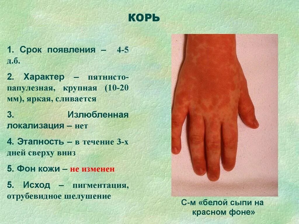 Вирусная экзантема код мкб
