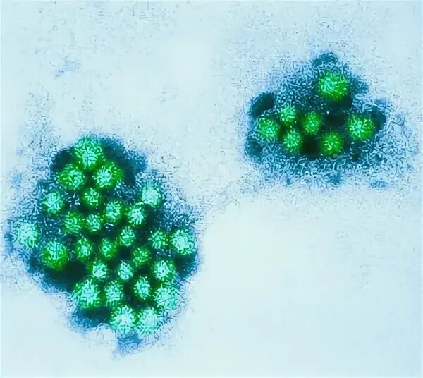Норовирус 2 генотип. Норовирус симптомы. Норовирус 3д изображение. Норовирус картинки.