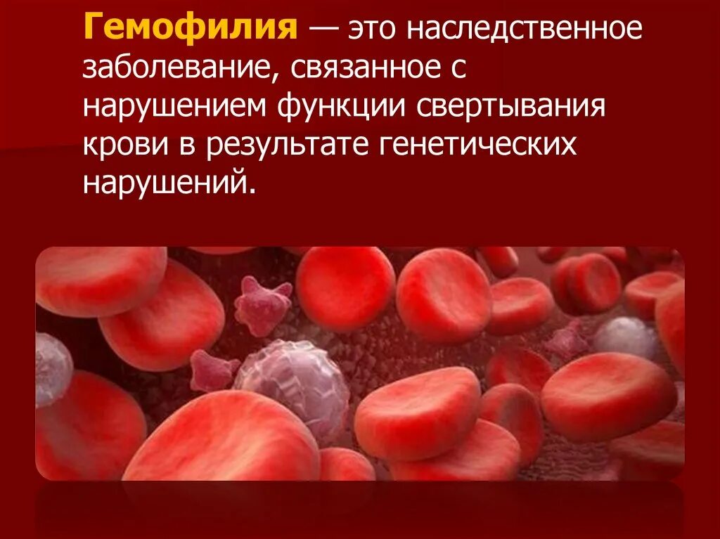 Заболевание анемия и гемофилия. Наследственные заболевания крови. Гемофилия и заболевание крови.