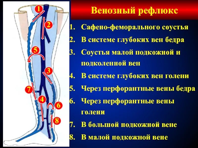 Перфорантные вены нижних конечностей анатомия. Перфорантные вены голени анатомия. Перфорантная Вена в средней трети голени это. Перфоранты вен нижних конечностей.