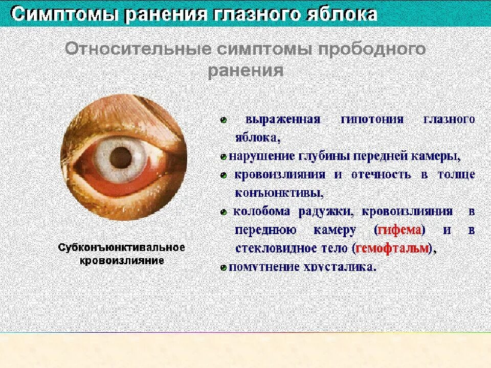 Укороченное глазное яблоко