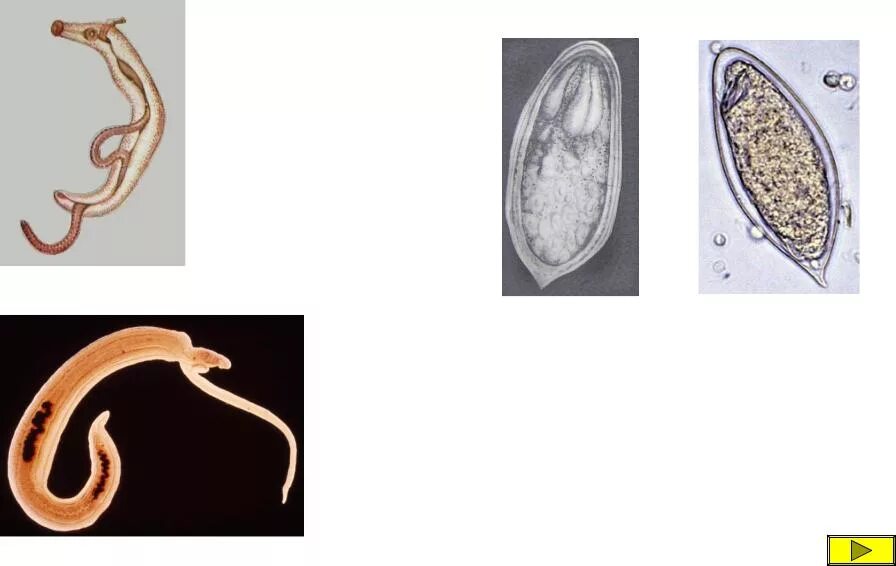 Шистосома haematobium. Шистосома гематобиум яйца. Schistosoma japonicum яйца. Кишечный сосальщик