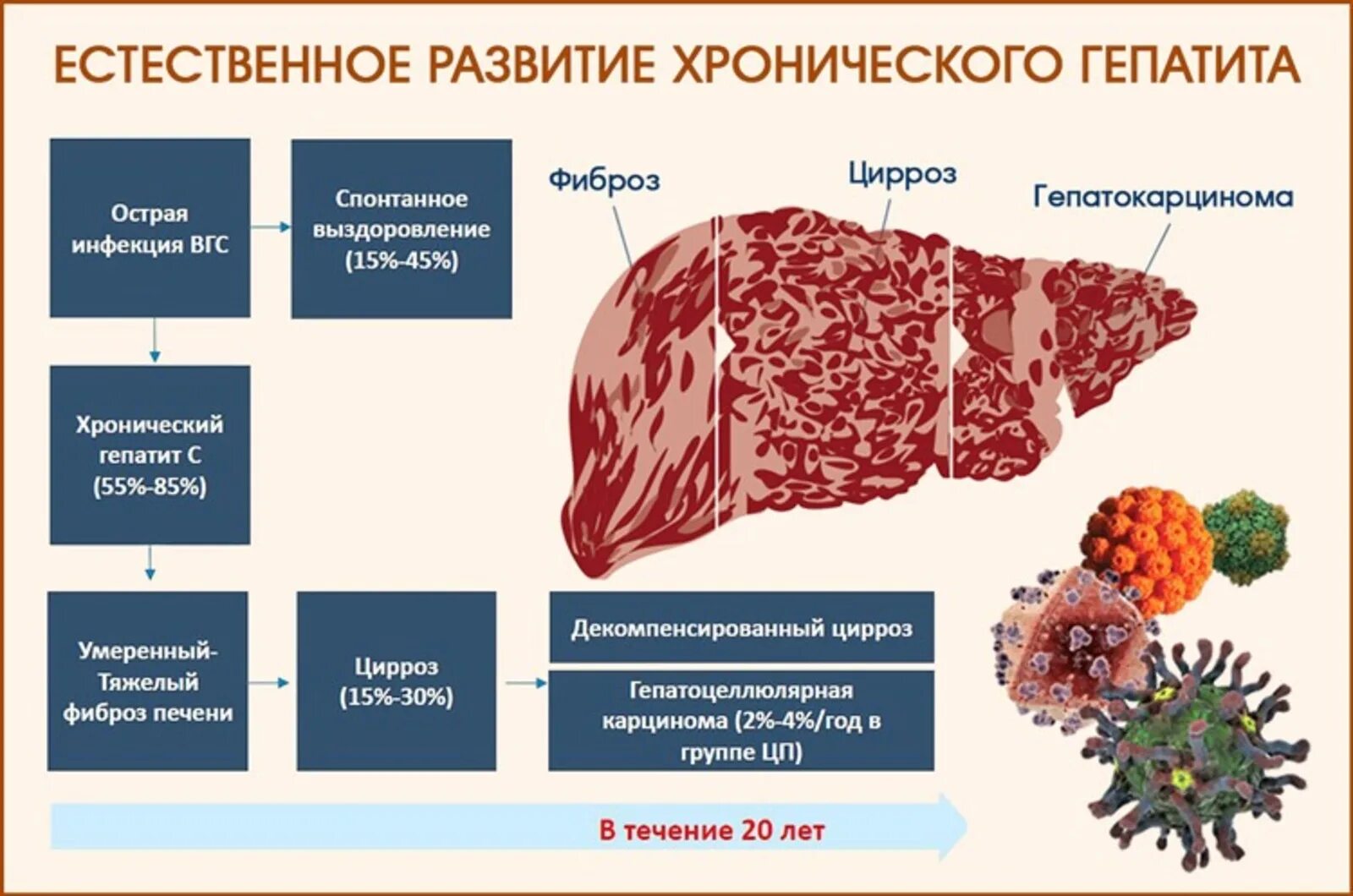 Клетки печени разрушаются. Хронический гепатит фазы вирус. Хронический гепатит б цирроз печени. Печеночные признаки хронического гепатита. Клинические симптомы хронического гепатита.